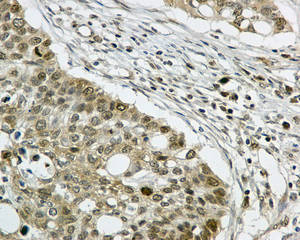 Immunohistochemistry (Formalin/PFA-fixed paraffin-embedded sections) - Anti-PDZRN4 [EPR11852] antibody (ab171083)