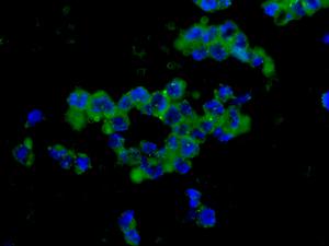 Immunocytochemistry/ Immunofluorescence - Anti-Dynein intermediate chain 1 antibody [EPR11244-61] (ab171964)