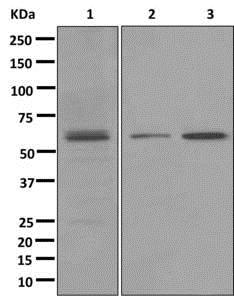 Western blot - Anti-PPAR delta [EPR5185(2)] antibody (ab173299)