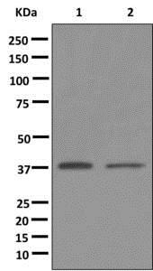 Western blot - Anti-GPCR GPR18 [EPR12359] antibody (ab174835)