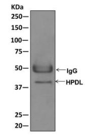 Immunoprecipitation - Anti-HPDL [EPR11691] antibody (ab174841)