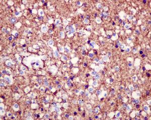 Immunohistochemistry (Formalin/PFA-fixed paraffin-embedded sections) - Anti-EAAT1 [EPR12685] antibody - N-terminal (ab176557)