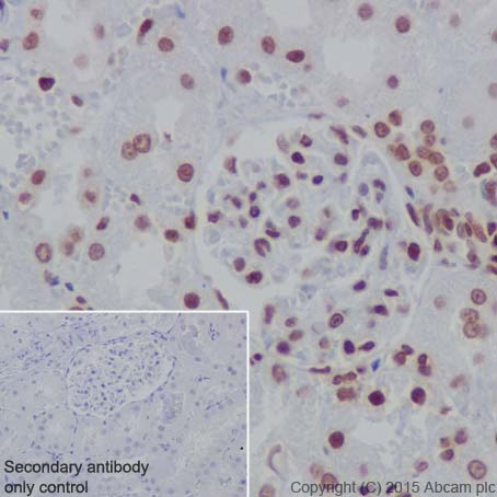 Immunohistochemistry (Formalin/PFA-fixed paraffin-embedded sections) - Anti-Histone H3 (formyl K122) antibody [EPR17896] (ab177306)