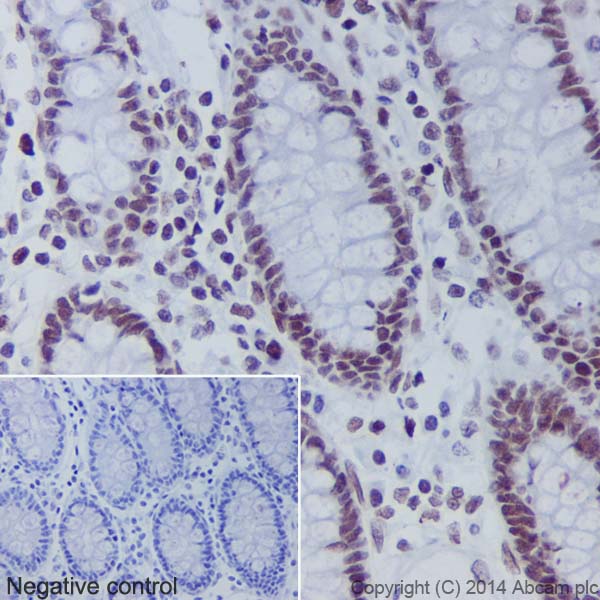 Peptide Array - Anti-Histone H2B (croto<i></i>nyl K5) antibody [EPR17483] (ab177396)