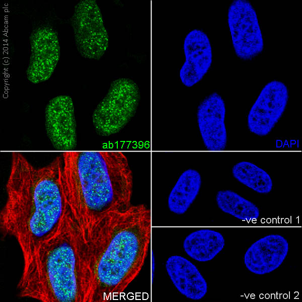 Immunohistochemistry (Formalin/PFA-fixed paraffin-embedded sections) - Anti-Histone H2B (croto<i></i>nyl K5) antibody [EPR17483] (ab177396)