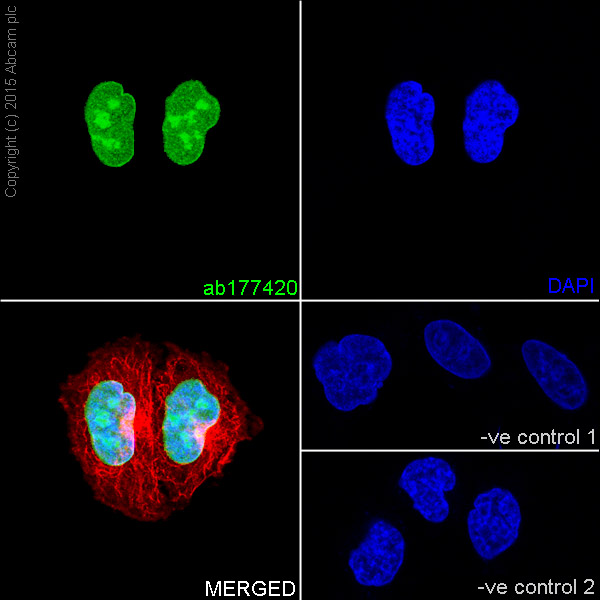 Immunohistochemistry (Formalin/PFA-fixed paraffin-embedded sections) - Anti-Histone H2B (croto<i></i>nyl K12) antibody [EPR17593] (ab177420)