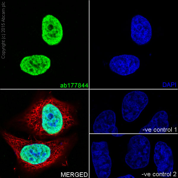 Immunocytochemistry/ Immunofluorescence - Anti-Histone H4 (croto<i></i>nyl K5) antibody [EPR17903] (ab177844)