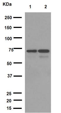 Western blot - Anti-Natriuretic Peptide Receptor C antibody [EPR12716] - C-terminal (ab177954)