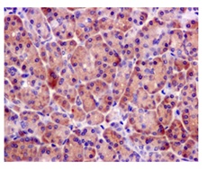 Immunohistochemistry (Formalin/PFA-fixed paraffin-embedded sections) - Anti-BRCC45 [EPR11858] antibody (ab177960)