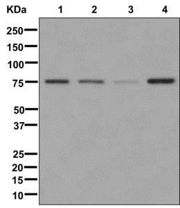 Western blot - Anti-NYREN18 [EPR10717] antibody (ab178414)