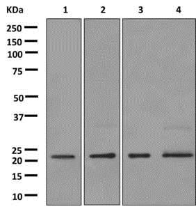 Western blot - Anti-Artemin [EPR9763] antibody (ab178434)