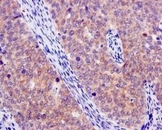 Immunohistochemistry (Formalin/PFA-fixed paraffin-embedded sections) - Anti-Artemin [EPR9763] antibody (ab178434)