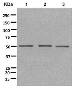 Western blot - Anti-DYNC1LI2 [EPR11230(2)] antibody (ab178702)