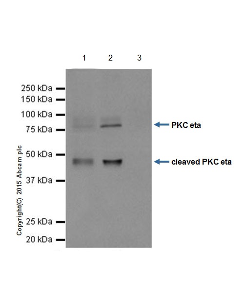 Immunoprecipitation - Anti-PKC eta antibody [EPR18513] (ab179524)