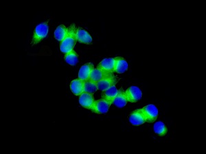 Immunocytochemistry/ Immunofluorescence - Anti-LOXL2 [EPR12733] antibody - C-terminal (ab179810)