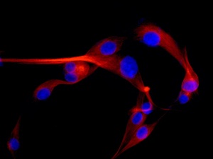 Immunocytochemistry/ Immunofluorescence - Anti-LOXL2 [EPR12733] antibody - C-terminal (ab179810)