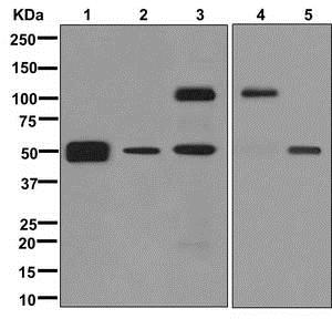 Western blot - Anti-LOXL2 [EPR12733] antibody - C-terminal (ab179810)