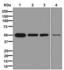 Western blot - Anti-Mo<i></i>nocarboxylic acid transporter 1 antibody [ERR13706(B)] - C-terminal (ab179832)