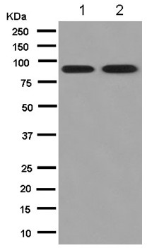 Western blot - Anti-ALS2CR8 [EPR13712] antibody (ab180142)