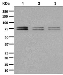 Western blot - Anti-DDX17 [EPR13807(B)] antibody (ab180190)