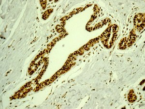 Immunohistochemistry (Formalin/PFA-fixed paraffin-embedded sections) - Anti-DDX17 [EPR13807(B)] antibody (ab180190)