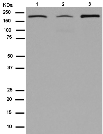 Western blot - Anti-NSD3 antibody [EPR13813] - N-terminal (ab180500)