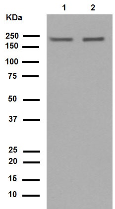 Western blot - Anti-NSD3 antibody [EPR13813] - N-terminal (ab180500)