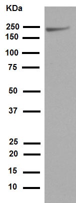 Western blot - Anti-NSD3 antibody [EPR13813] - N-terminal (ab180500)