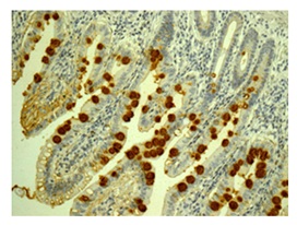 Immunohistochemistry (Formalin/PFA-fixed paraffin-embedded sections) - Anti-CLCA1 [EPR12254-88] antibody (ab180851)