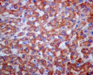 Immunohistochemistry (Formalin/PFA-fixed paraffin-embedded sections) - Anti-COPE [EPR12579] antibody (ab180946)