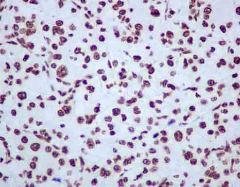 Immunohistochemistry (Formalin/PFA-fixed paraffin-embedded sections) - Anti-hnRNP U [EPR12278(2)(B)] antibody (ab180952)