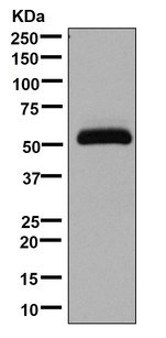 Western blot - Anti-Intrinsic Factor [EPR13488(B)] antibody - C-terminal (ab181045)