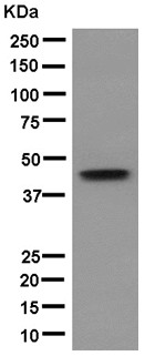 Western blot - Anti-KRT31 [EPR12849] antibody - N-terminal (ab181081)