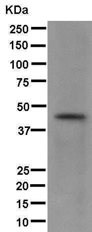 Western blot - Anti-KRT31 [EPR12849] antibody - N-terminal (ab181081)