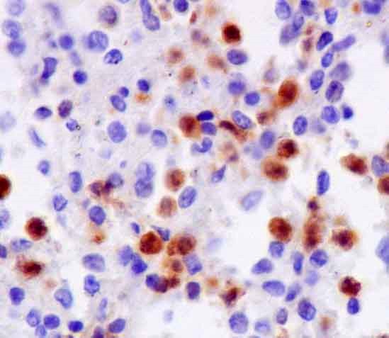 Immunohistochemistry (Formalin/PFA-fixed paraffin-embedded sections) - Anti-NCF1 [EPR13134-23] antibody (ab181090)