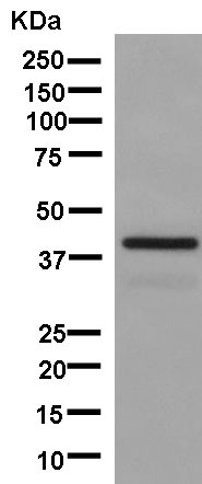 Western blot - Anti-Actin Regulatory Protein CAPG [EPR13194-34] antibody (ab181095)