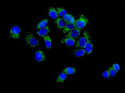 Immunocytochemistry/ Immunofluorescence - Anti-CPT2 [EPR13626] antibody - C-terminal (ab181114)