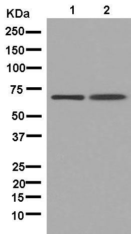 Western blot - Anti-CPT2 [EPR13626] antibody - C-terminal (ab181114)