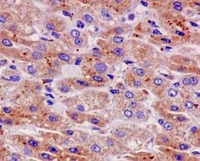 Immunohistochemistry (Formalin/PFA-fixed paraffin-embedded sections) - Anti-CPT2 antibody [EPR13626] - C-terminal (ab181114)