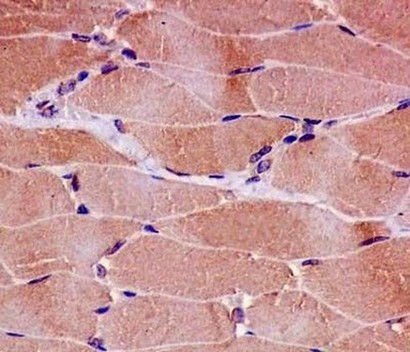 Immunohistochemistry (Formalin/PFA-fixed paraffin-embedded sections) - Anti-CPT2 antibody [EPR13626] - C-terminal (ab181114)