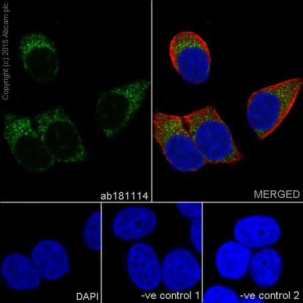 Immunocytochemistry/ Immunofluorescence - Anti-CPT2 antibody [EPR13626] - C-terminal (ab181114)