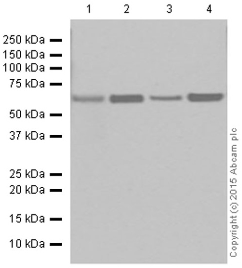 Western blot - Anti-CPT2 antibody [EPR13626] - C-terminal (ab181114)