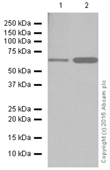 Western blot - Anti-CPT2 antibody [EPR13626] - C-terminal (ab181114)