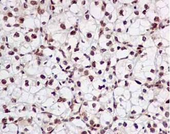 Immunohistochemistry (Formalin/PFA-fixed paraffin-embedded sections) - Anti-FUBP3 [EPR13174-61] antibody (ab181122)