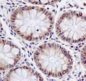 Immunohistochemistry (Formalin/PFA-fixed paraffin-embedded sections) - Anti-FUBP3 [EPR13174-61] antibody (ab181122)