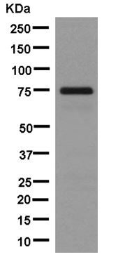 Western blot - Anti-ARHGAP25 [EPR13233] antibody (ab181202)