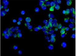 Immunocytochemistry/ Immunofluorescence - Anti-ARHGAP25 [EPR13233] antibody (ab181202)