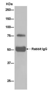 Immunoprecipitation - Anti-ARHGAP25 [EPR13233] antibody (ab181202)