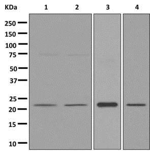 Western blot - Anti-APOBEC3C [EPR13417] antibody (ab181356)