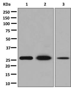 Western blot - Anti-Carbo<i></i>nic Anhydrase III [EPR13425] antibody (ab181358)